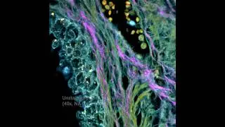 Multi-photon image of human prostate