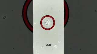 Something LIVING in chlorine POOL WATER! 1000x magnification!