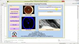 Iris Recognition System using Image Processing Matlab Project with Source Code