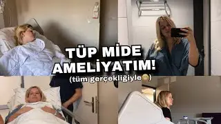 Tüp Mide Ameliyatım (Tüm Gerçekliğiyle😬) + Önceki & Sonraki Gün • VLOG