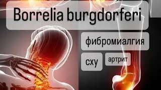 Боррелия | Borrelia burgdorferi - Фибромиалгия, синдром хронической усталости, депрессия, артрит