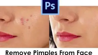 How To Remove Pimples From Face in Photoshop CS6