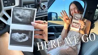 clomid results, ultrasound, and follicles!!!
