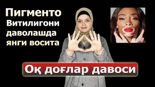 Витилигони 7 кунда енгинг | Vitiligoni 7 kunda yenging