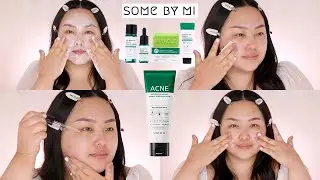 SOME BY MI ACNE SKINCARE REVIEW AHA BHA PHA MIRACLE | STYLEVANA