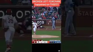 Shocking craziest baseball injury