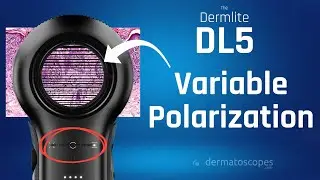 Dermlite DL5 - What Is Variable Polarization?