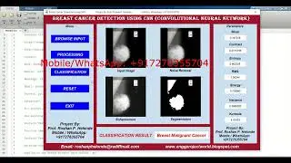 Detection Of Breast Cancer Using CNN Matlab Project With Source Code Breast Cancer Classification
