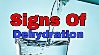 Signs of Dehydration|knowledge madnoob