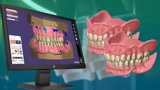 The Workflows for A Patient's Duplicate and Copy Dentures