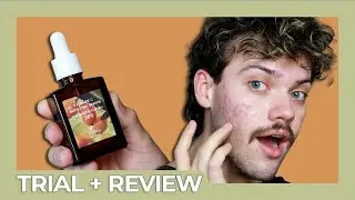 dr althea vitamin c boosting serum | trial + review