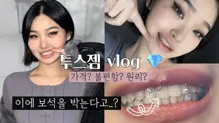 투스젬 후기 브이로그🦷💎| 이제 이에도 보석을 박는다고..?!😬 | 궁금한점 다 알려줄게! | 홍대 비투씨 | Toothgem vlog | betoothy