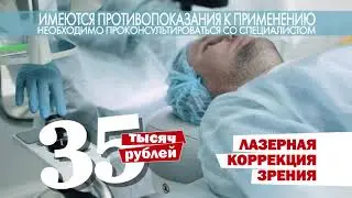УК ЛАЗЕР 35000