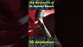 Demystifying Asthma: Understanding the Mechanics of an Asthma Attack