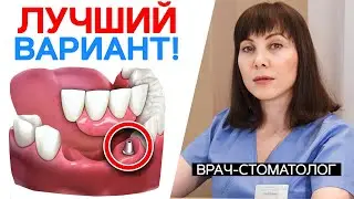 How to Affordably Restore Your Teeth in 2025! / Dentures or Implants?