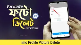 imo profile picture delete - ইমু প্রোফাইল পিকচার চেঞ্জ