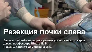 Резекция почки слева. Оперирует Игорь Владимирович Семенякин.