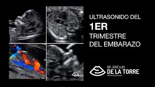 ¿Qué es el ultrasonido de tamizaje del primer trimestre?