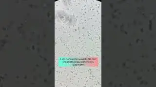 Положительный MAR тест