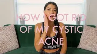 Clear Skin from within! How i cured my Cystic Acne and how you can too!