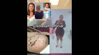 Actress  Olaide undergoes  BumBunm surgery watch what happened  after