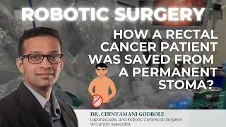 A Rectal Cancer Patient Saved from Permanent Stoma by Robotic Surgery - Dr. Chintamani Godbole