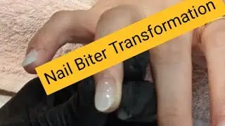 Extension for Nail biter challenge #naildesign #trending #tutorial #viralvideo #acrylicnails #diy