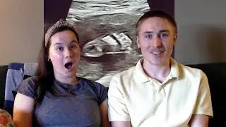 Halfway There! Our 20 Week Pregnancy Update