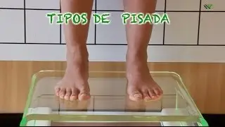 The easiest way to differentiate a neutral, pronated or supinated gait