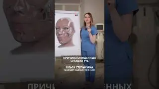 ПОЧЕМУ НА САМОМ ДЕЛЕ ОПУСКАЮТСЯ УГОЛКИ РТА ✅