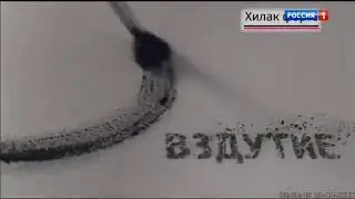 Рекламный блок, баг (Россия 1, 29.08.2017)