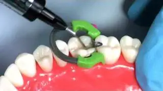 Tokuyama Product Directions for Use Video
