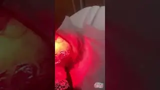 Terapia fotodinâmica