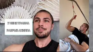 Разрыв Ахилла. 3 недели после операции. Восстановление. Тренировки. Реабилитация.