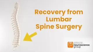 What to Expect After Your Lumbar Spine Surgery