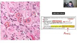 NEUROPATHOLOGY: BOARD REVIEW 2