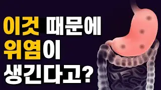 위에 염증이 생기고, 속이 쓰린 위염의 원인은?｜허봉수 원장