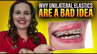 Why Unilateral Elastics (Class 2 Class 3) are a BAD Idea in Braces or Invisalign