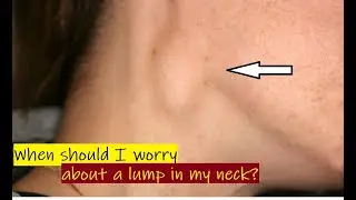 When should I worry about a lump in my neck?