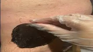 Male arms waxing session