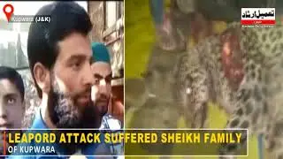 Leapord Attack Suffered Sheikh Family Of Kupwara