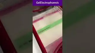 Gel Electrophoresis Technique