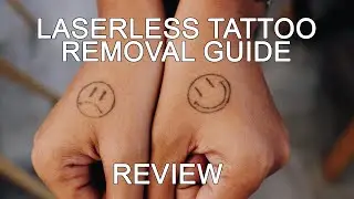 Reviewing The Laserless Tattoo Removal Guide - Is It Scam or Is It Real? Watch To Find Out
