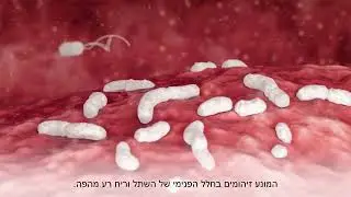 דובב גרינברג קריינות מקצועית- קריינות טלוויזיה עבור רויאל דנט