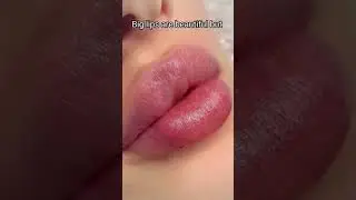 big lips are beautiful but this