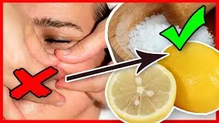 Pickel loswerden und Mitesser entfernen mit Zitrone Salz Peeling Hausmittel