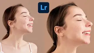 Face retouching in lightroom mobile | pimples remove in 2 minutes