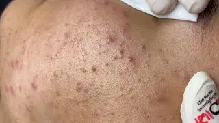 Satisfying Relaxing #ThuyTruong549