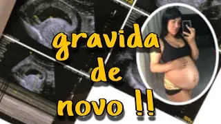 ESTOU GRAVIDA | 28 SEMANAS DE GESTAÇÃO | ESTRIAS NA  GRAVIDEZ 😰