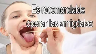 Extirparte las amígdalas podría ser una muy mala idea